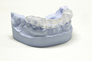 Surgical dental dental transparent pattern on the plaster model. mouth guard